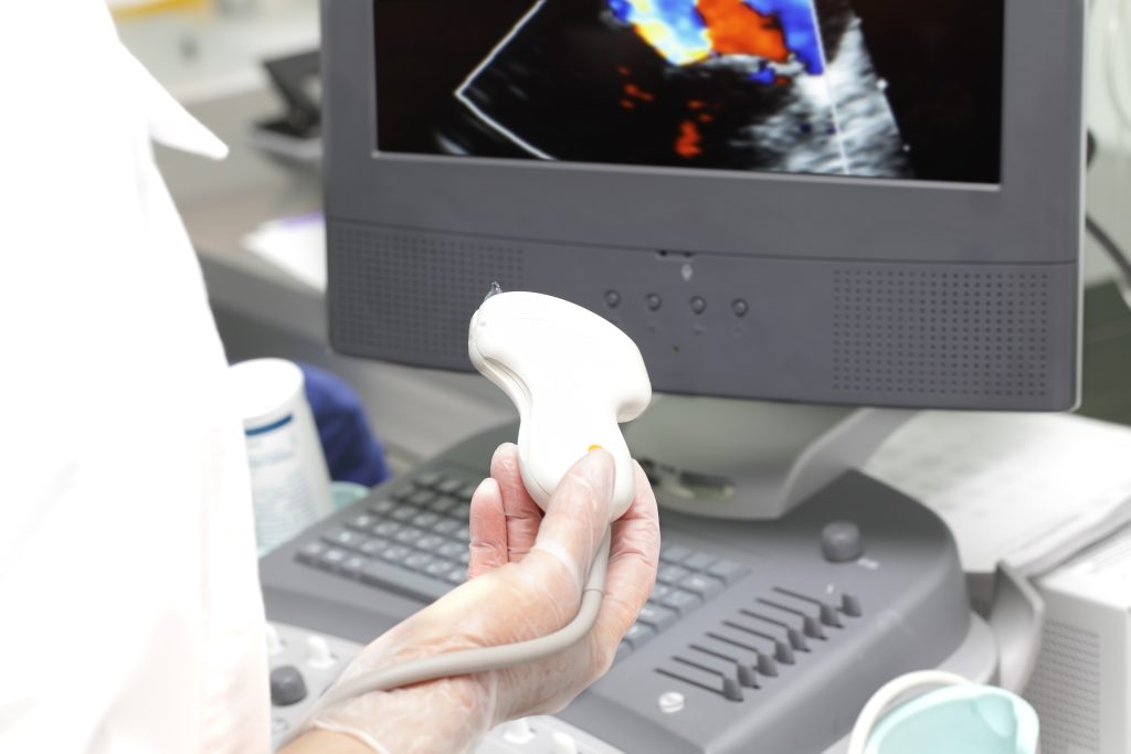 ultrasound scan