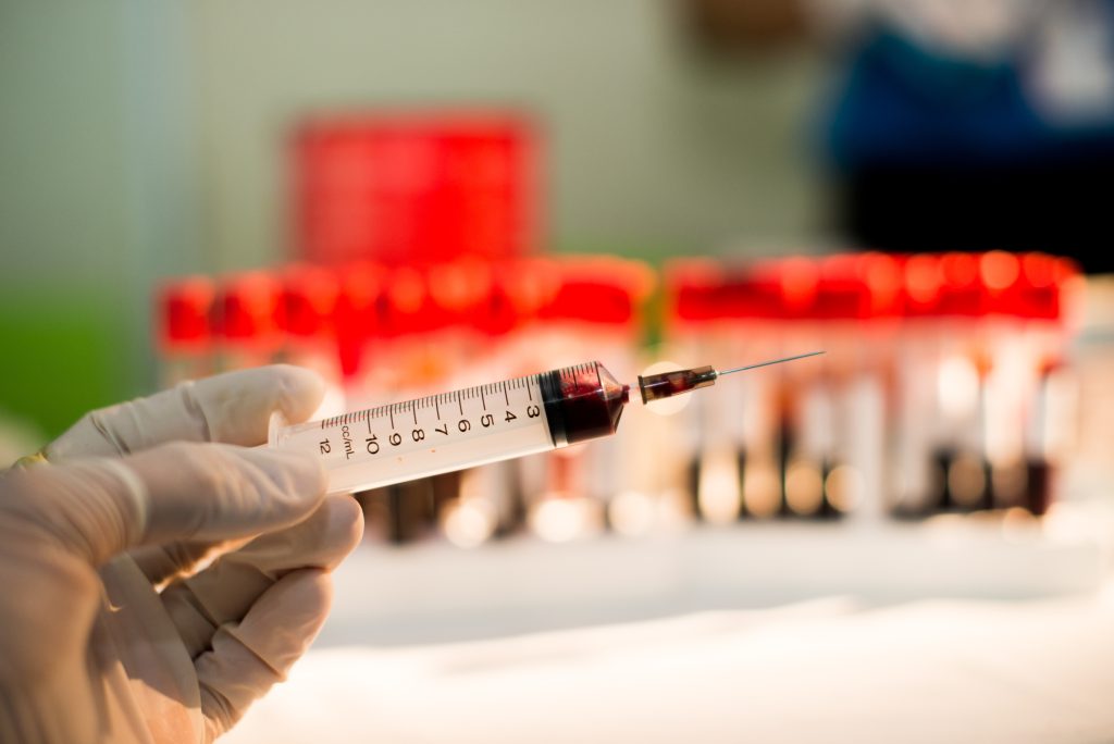 Blood Test Malaysia