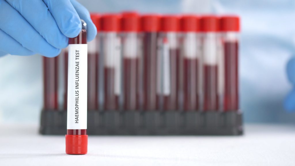 Blood Test