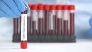 Blood Test